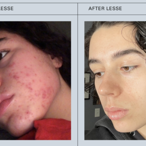 before and after ritual serum